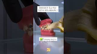 Breket İlə Nə Yeyə Bi̇lərsi̇ni̇z?