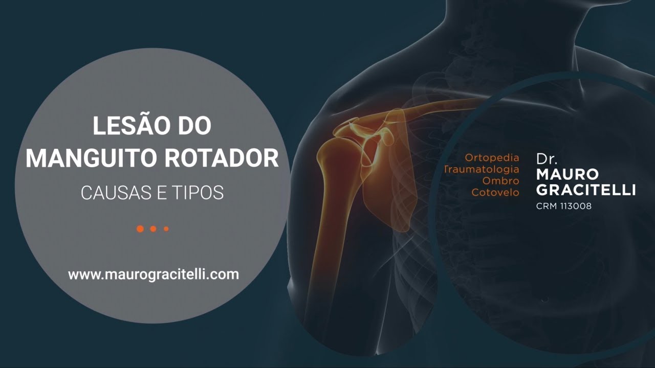 Lesão do manguito rotador: causas e consequências - Entenda tudo sobre