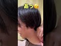 肺ギリギリの肩こりをゴリゴリ鍼で治します