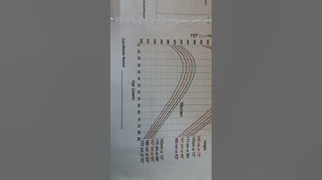 #PeakFlow Tutorial. #HowToPlot #HowToInterpret #OSCEMadeEasy