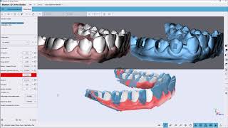 Maestro 3D | Dental Studio | Virtual Setup | Models Builder