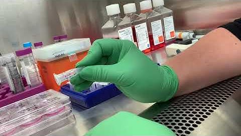 Caspase Assay and RNA lysis