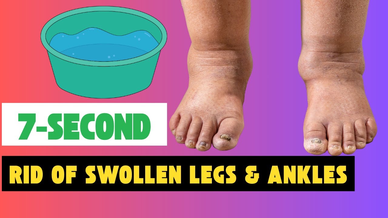 7-Second “Water Dumping” Fix Gets You Rid of Swollen Legs & Ankles