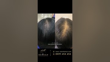 Điêu khắc tóc nữ hay phun vi chạm tóc nữ thưa hình khác nhau như nào