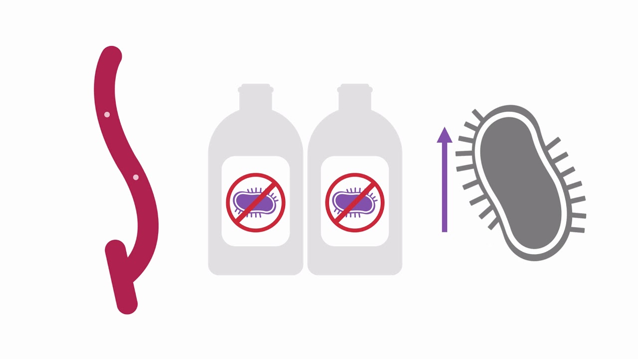 Recognizing hemodialysis fistula and graft infections