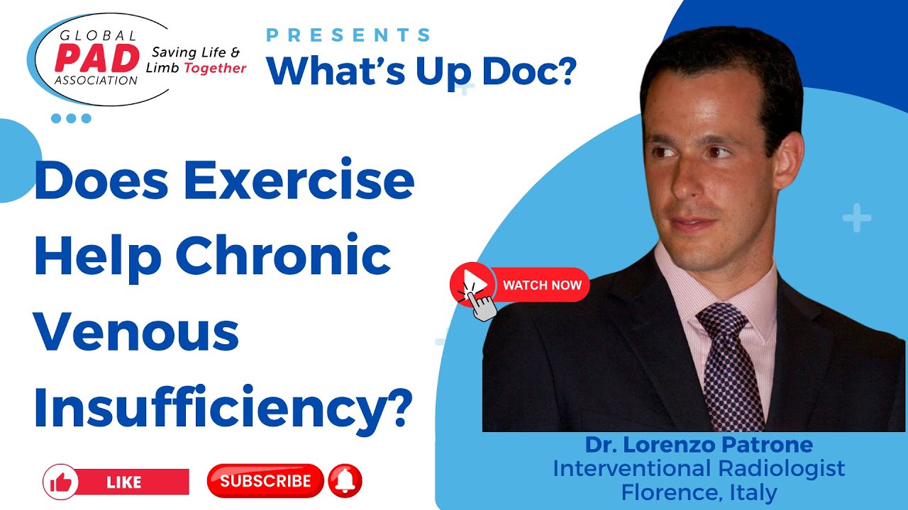 Does Exercise Help Chronic Venous Insufficiency | Dr. Lorenzo Patrone