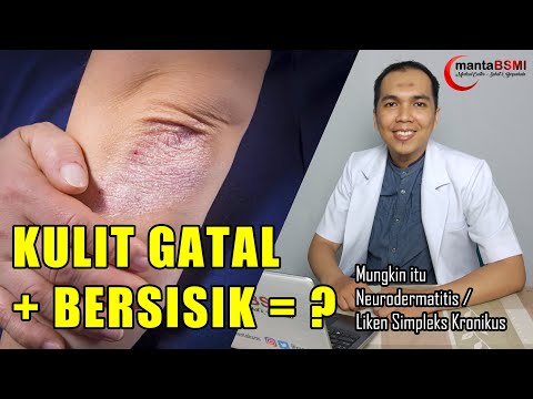 Cari tahu segala hal tentang kulit bersisik dan gatal (Edukasi tentang Neurodermatitis)