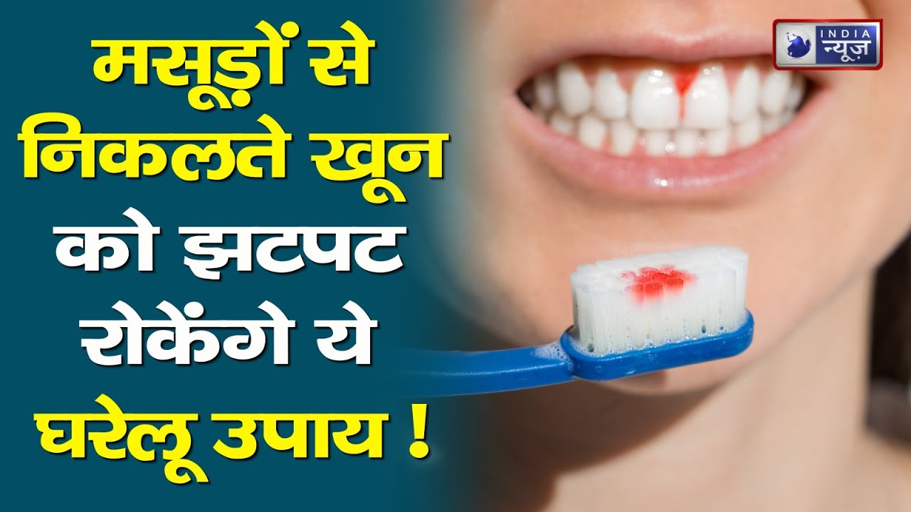 Gum Bleeding Remedies मसूड़ों से खून आ रहा है? तो जानिए इसके कारण और