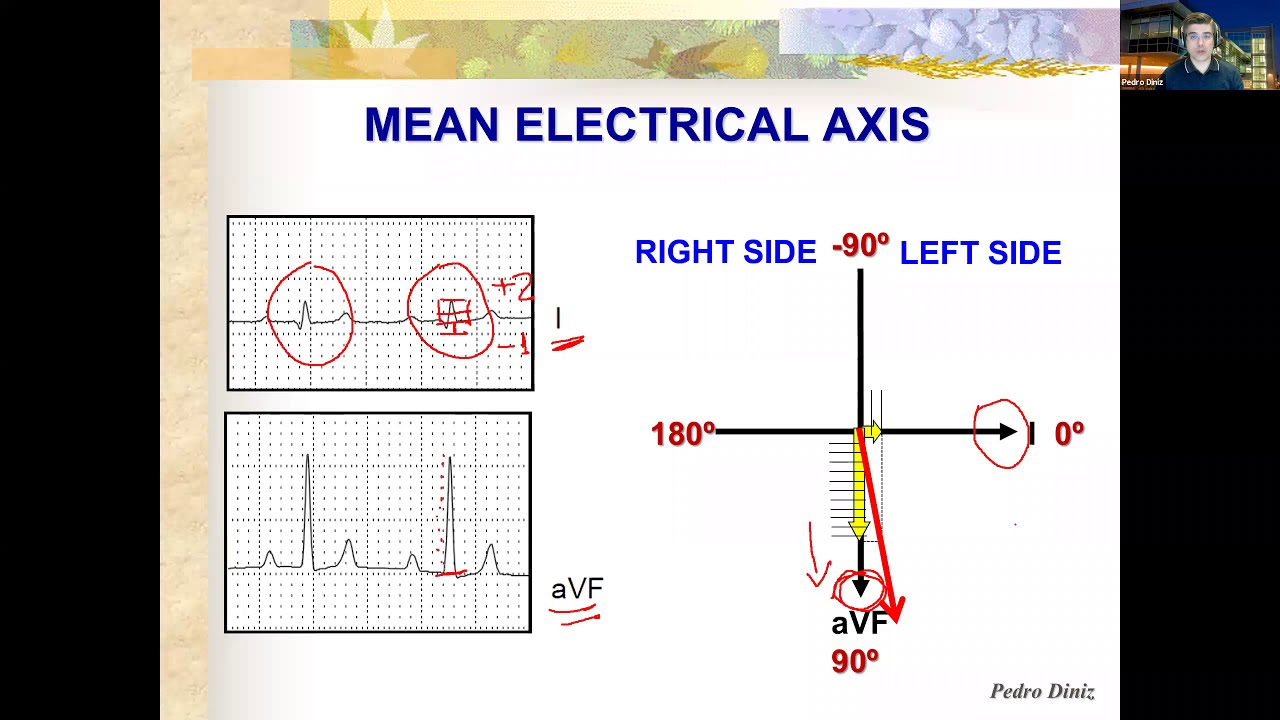 Mean axis. Mean axis