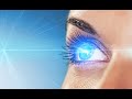 Лазерная коррекция зрения iQ-LASIK Oxygen 3D после месяца, видео отчёт.