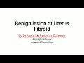 Benign lesion of uterus fibroid