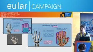 EULAR Campaign: The Use of Interactive Augmented Reality Posters as a Public Engagement Tool