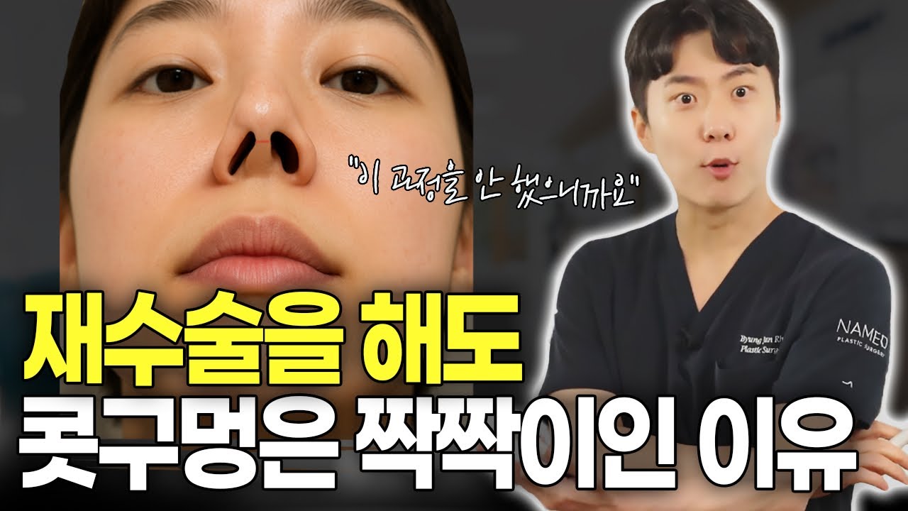 콧구멍 비대칭이 안 고쳐지는 진짜 이유 (해결법 有)