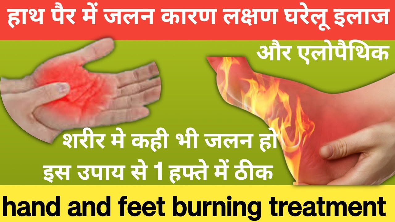 हाथ पैर में जलन कारण लक्षण घरेलू इलाज why hands and feet burning in