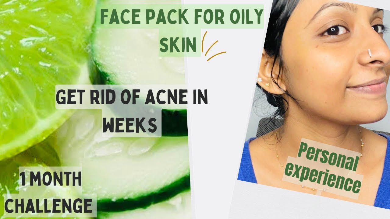 Get pimple free face face pack for oily skin💚 nly 3 ingredients 😊1