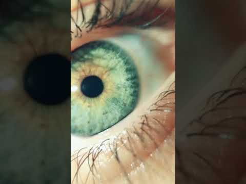 أم عيون الخضر حالات واتس 