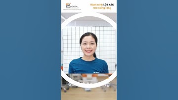 Hành trình LỘT XÁC nhờ niềng răng của Lâm Linh