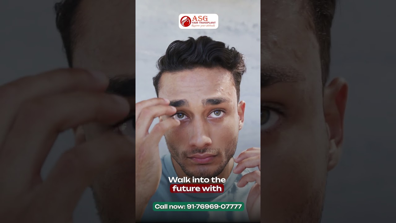 ASG Hair Transplant Centre – Advanced Solutions for Hair Loss in Men & Women