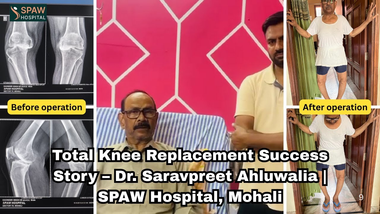 Life After Total Knee Replacement | SPAW Hospital Review | Dr. Saravpreet Ahluwalia