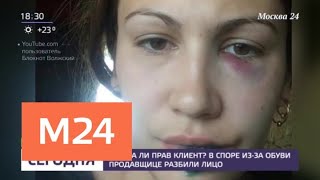 В споре из-за обуви продавщице разбили лицо - Москва 24 В споре из-за обуви продавщице разбили лицо - Москва 24