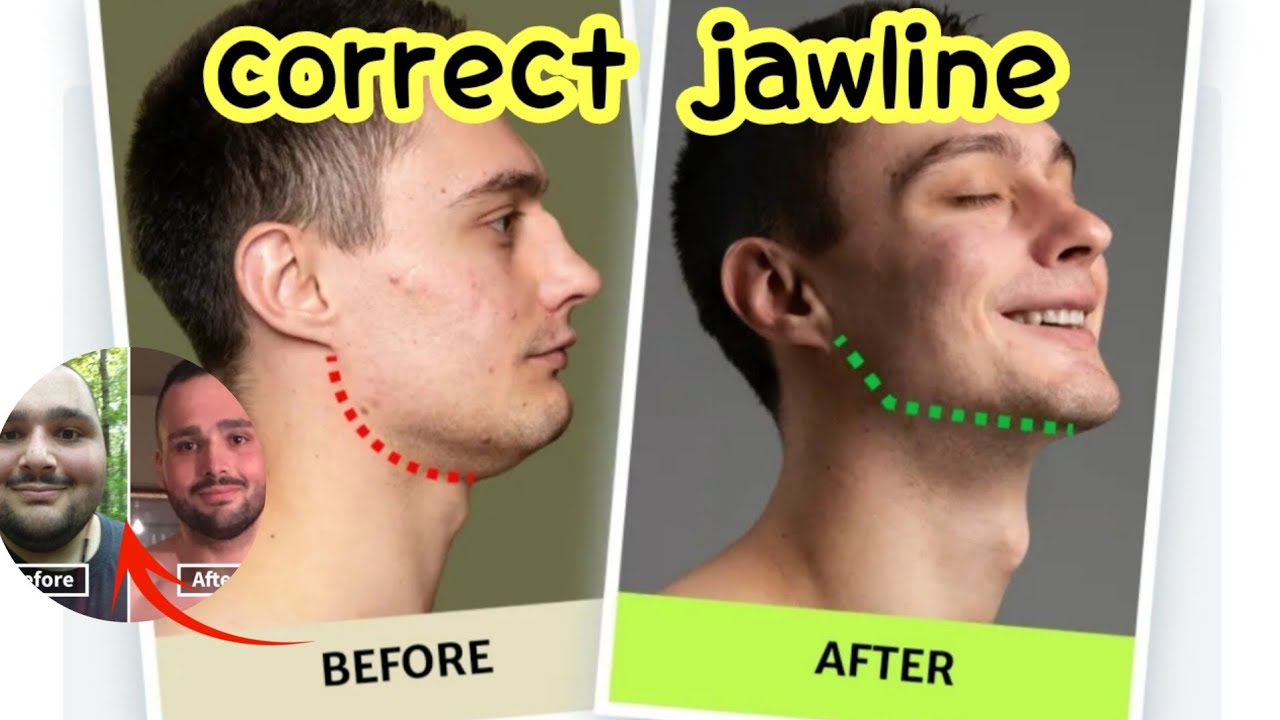 How To Get a More Defined Jawline || in only 6 mintue - YouTube