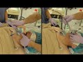 【挿管】ファストラック(LMA Fastrach)挿管_声門上器具(SGA)を介した気管挿管