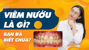 Viêm Nướu Là Gì? Bạn Đã Biết Chưa? | Nam Bùi Vinalign