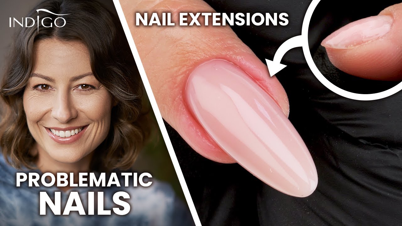 Nails growing upwards and downwards - how to extend problematic nails with gel? | Indigo Nails