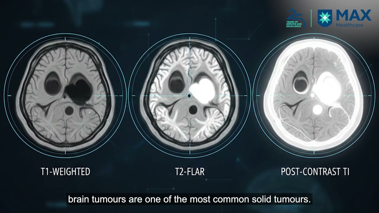 *Understanding Neurological Diseases & Brain Tumours In Children