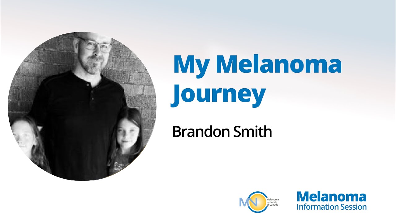 My Stage 4 Melanoma Journey YouTube
