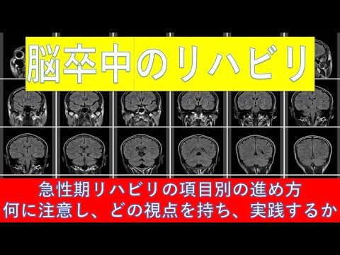 脳卒中最前線 : 急性期の診断からリハビリテーションまで 脳卒中最前線 第4版 急性期の診断からリハビリテーションまで/医