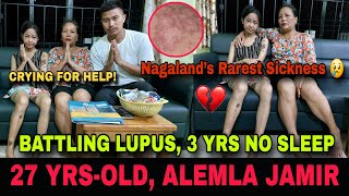 Download Lagu 27-jarige Alemla Jamir vecht tegen lupus 💔 Slaaploos 3 jaar MP3 Download Lagu 27-jarige Alemla Jamir vecht tegen lupus 💔 Slaaploos 3 jaar MP3