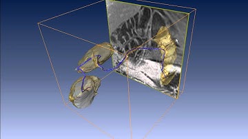 VIGOR++ :: Segmentation of MRI scan of the abdomen