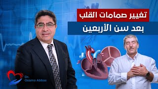 تغيير صمامات القلب بعد سن الاربعين | دكتور اسامة عباس