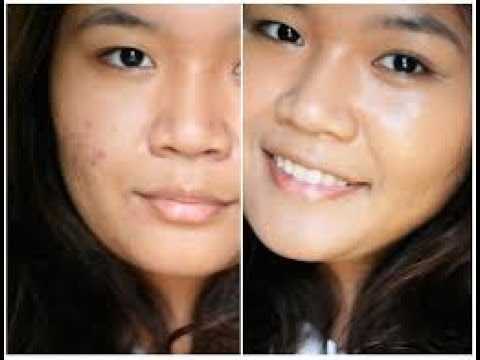 KETAHUILAH 10 Cara Menghilangkan Flek Hitam Bekas KETAHUILAH 10 Cara Menghilangkan Flek Hitam Bekas