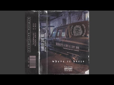 在 YouTube 上观看 Where It Hurts (feat. RedLine & Royal Lion Mob)