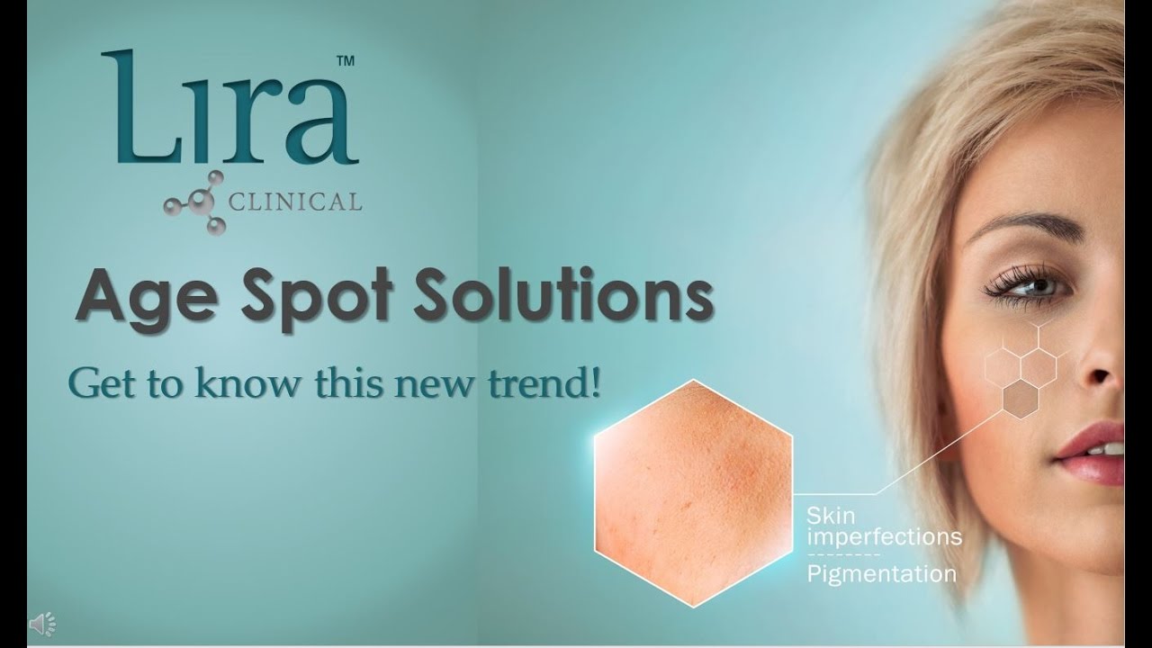 Age Spots Solutions: Get to know this new trend!