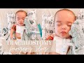 EZZY'S *TRACHEOSTOMY* surgery!! NICU day in the life