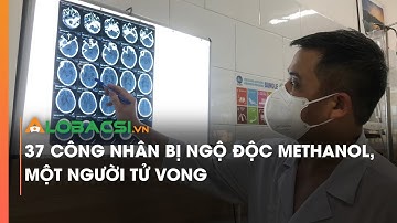 37 công nhân bị ngộ độc methanol, một người tử vong