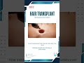 How Hair Transplant Really Works | 3D Medical Animation #shorts