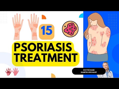 Video: 3 modi per trattare la psoriasi eritrodermica