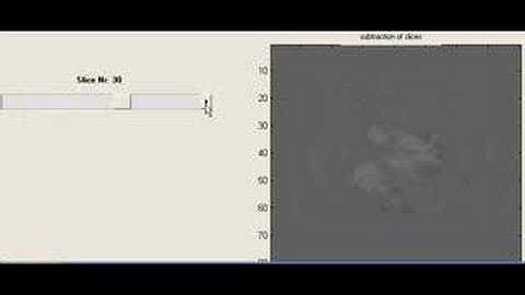 Contiguous volumes - slice by slice differences