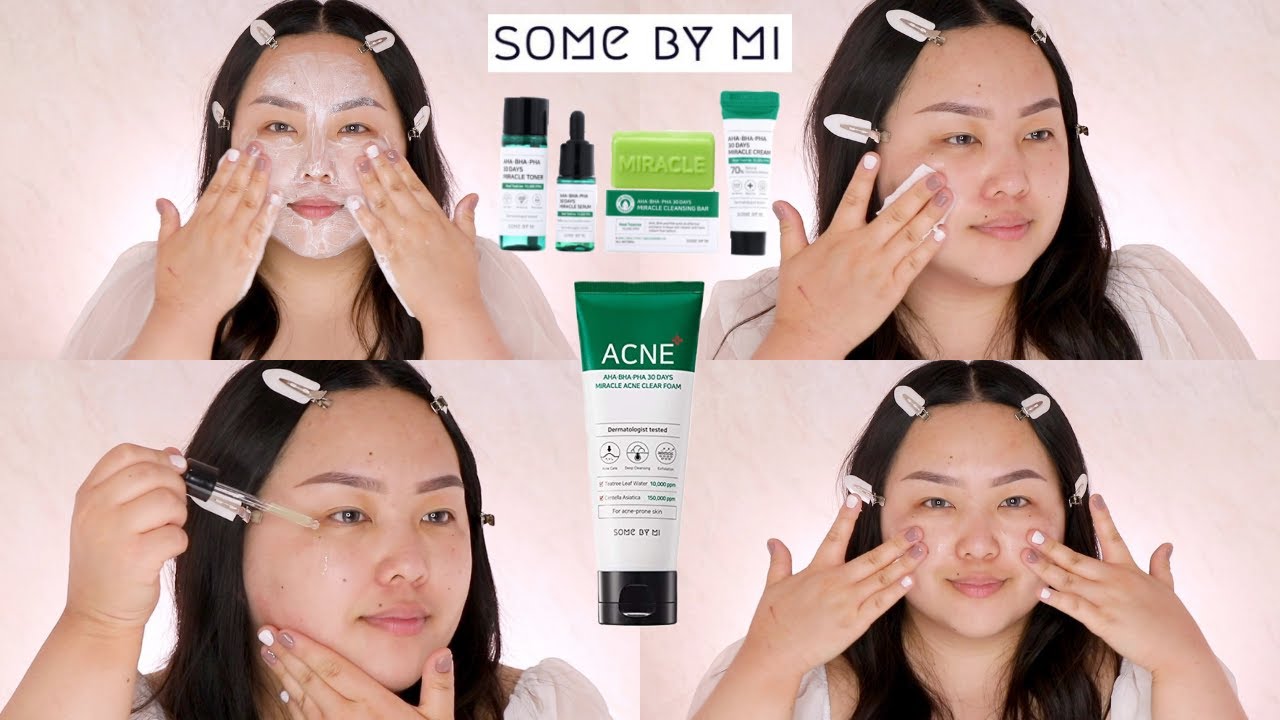 SOME BY MI ACNE SKINCARE REVIEW AHA BHA PHA MIRACLE