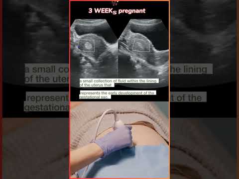 3 weeks, pregnancy