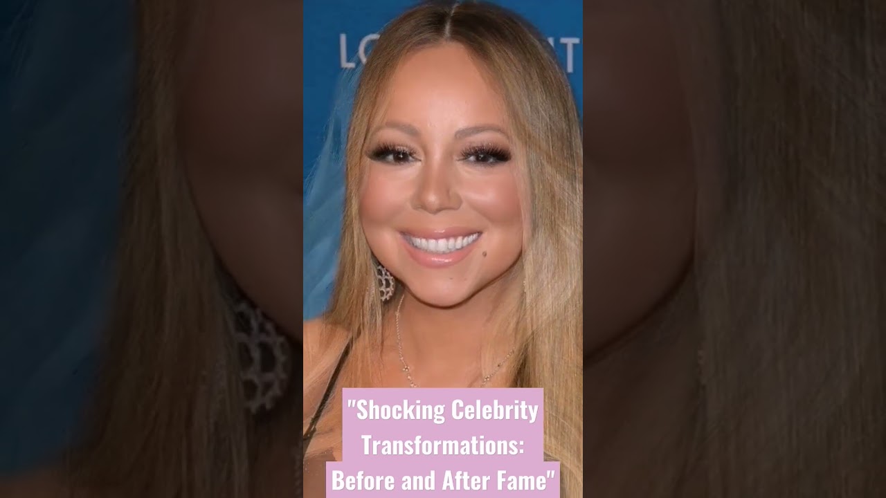Shocking Celebrity Transformations: Before and After Fame
