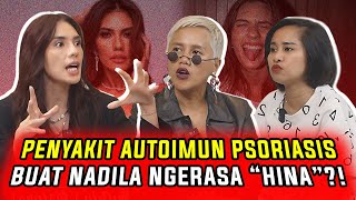 PENYAKIT AUTOIMUN PSORIASIS BUAT NADILA ERNESTA NGERASA “HINA”?! | WaOde Sisters Eps 80 Part 1