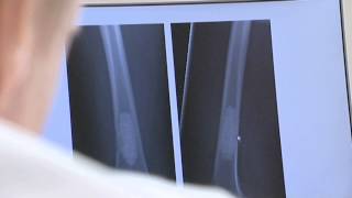 Bonalive Bone formation WMV
