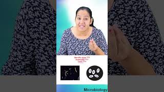 1 minute learning:   Negetive stain