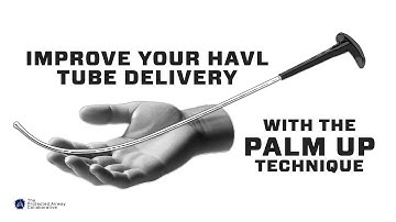 Hyperangulated Video Laryngoscopy - Palm Up Technique