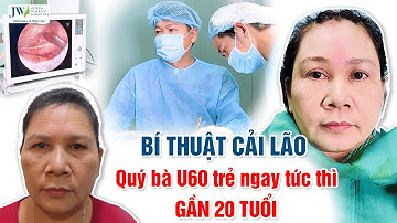 Bác sĩ Tú Dung trình làng Treo chân mày nội soi 4X giúp chị em bị TUỔI GIÀ ĐEO BÁM trẻ ngay 20 tuổi